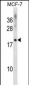 CMTM5 Antibody (Center)